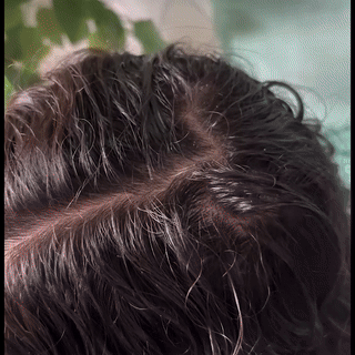 Hair Recovery bundle (Kerahaire shampoo  Kerahair lotion  Kerahair serum  Derma roller (GIFT))