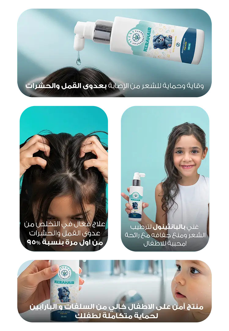 كيرا هير انتي لايس لوشن ( 1+1 هدية )