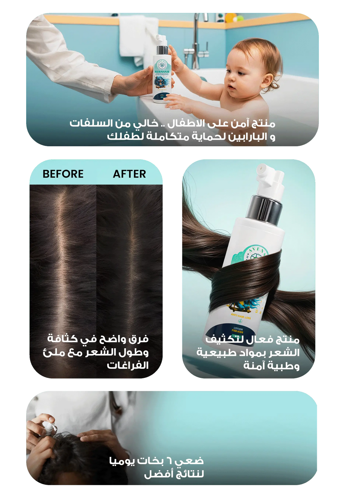 كيرا هير لوشن للعناية بشعر الاطفال (1+1 هدية )