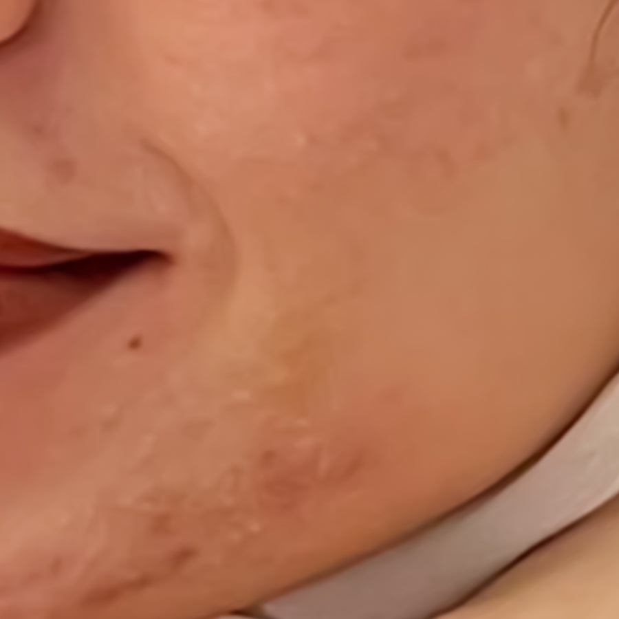 قبل